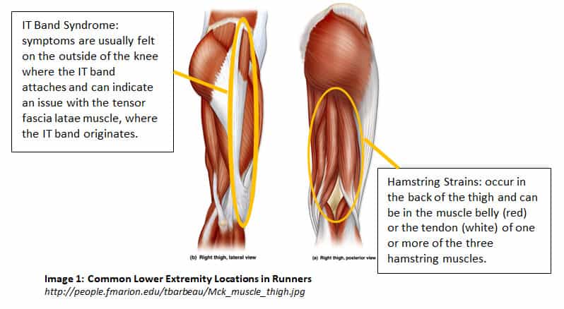 Common Injuries in Runners: Hamstring Strains + IT Band Syndrome - Robert  Fronjian
